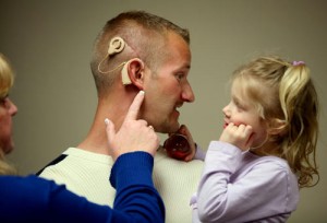 Restored Hearing - Cochlear Implant